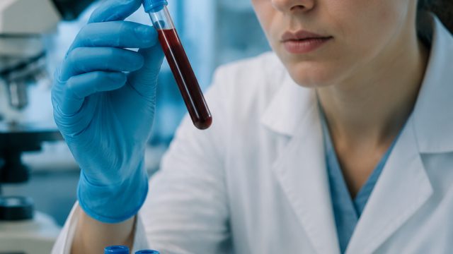 Revolutionary Blood Test for Cancer Detection on the Horizon | keluaran tgl hk mlm ini, vivo x50 ear